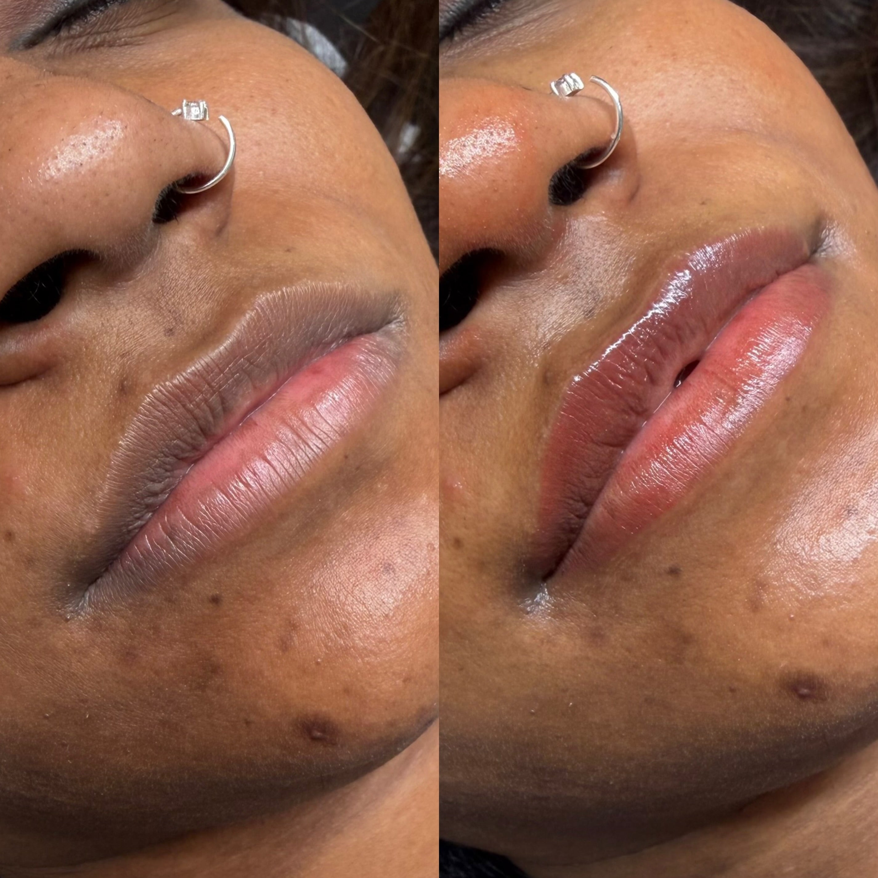 Lip Neutralisation Tattoo South West Sydney: A Guide to Dark Lip Colour Correction