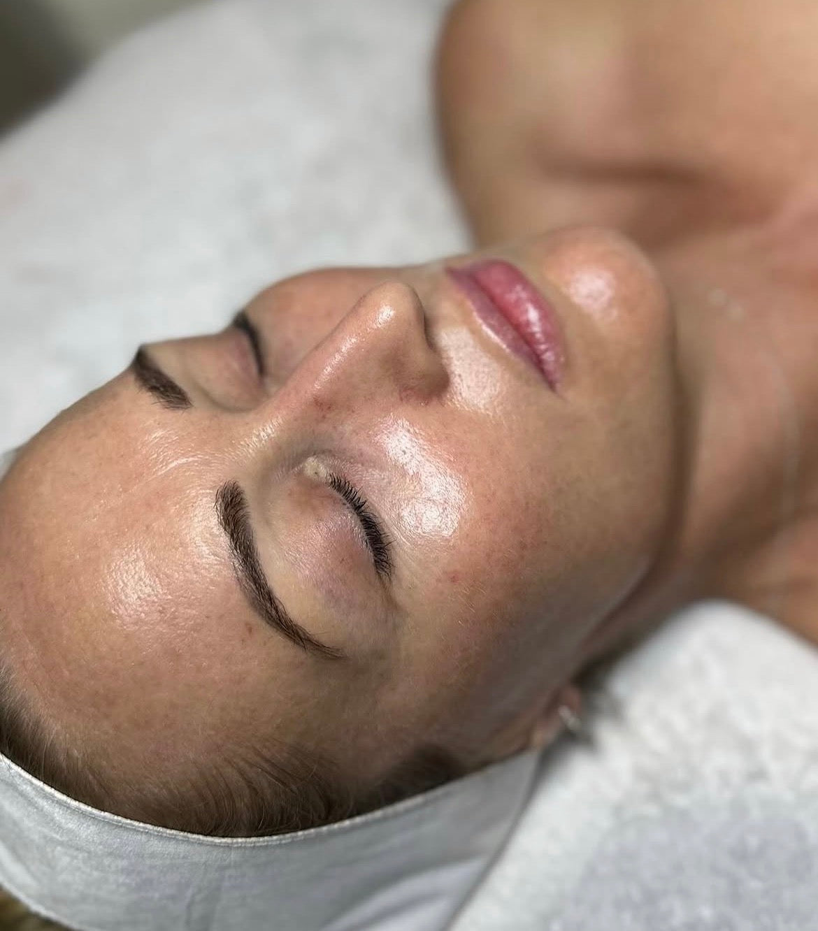 Glass Skin Facial South West Sydney: What It Is, Benefits and What to Expect